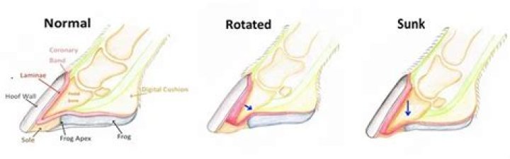 Are founder and laminitis the same?