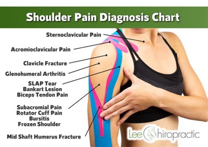 Can cold cause shoulder pain?