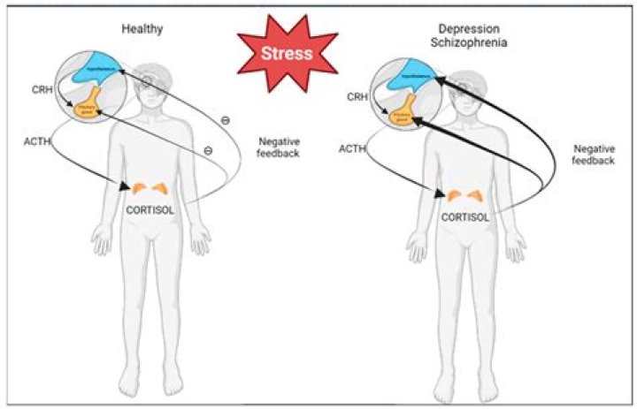 Can stress cause high prolactin levels?