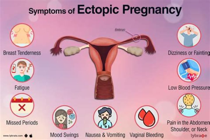 Do ectopic pregnancies hurt?