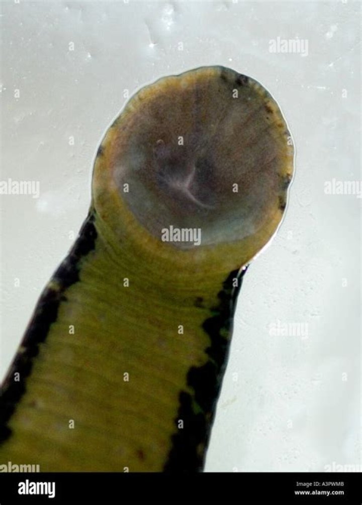Do leeches have teeth?
