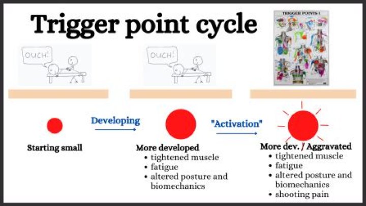 Do trigger points go away?