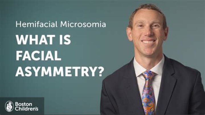 Does hemifacial microsomia affect the brain?