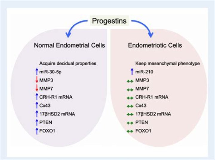 Does progestin cause cancer?