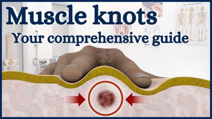 How knots are formed in your back?