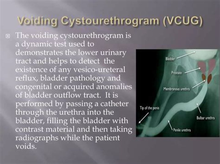How voiding cystourethrography is performed?