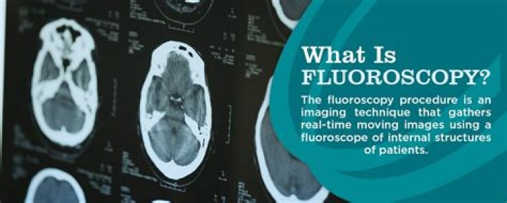 What does a fluoroscopy do?