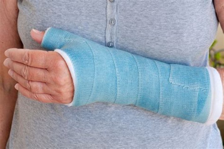 What is a fiberglass cast?