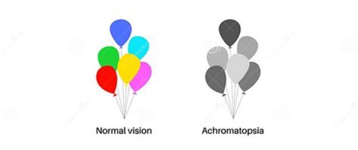 What is cerebral achromatopsia?