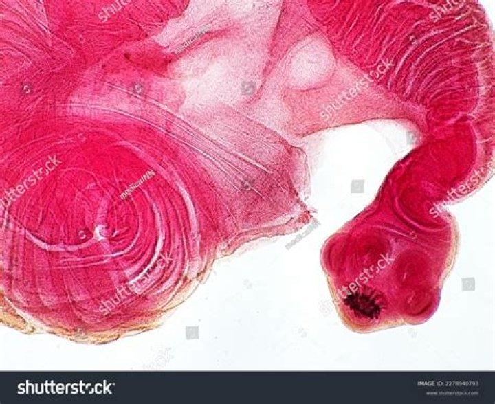 When cysticerci are present in pork it is called?