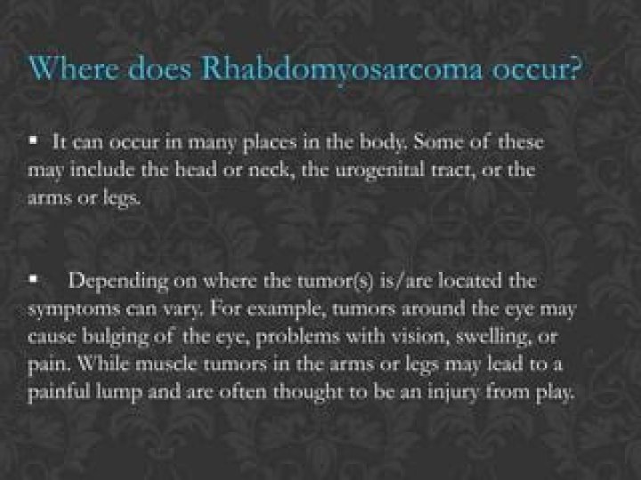 Where does rhabdomyosarcoma occur?