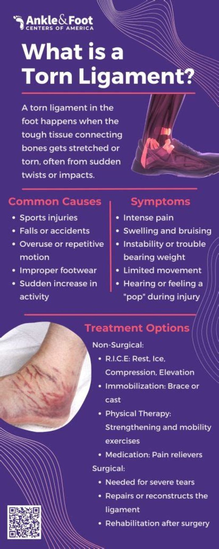 Who is torn ligament?