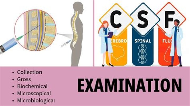 Why csf test is done?