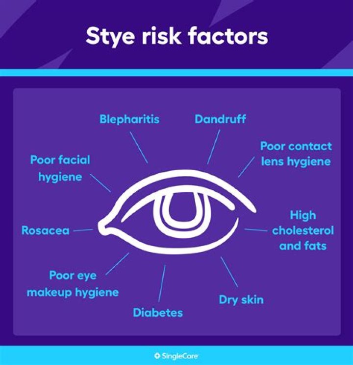 Why do i keep getting styes all of a sudden?