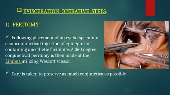 Why enucleation of the eye is done?
