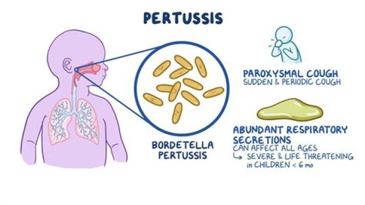 Why is pertussis re-emerging?