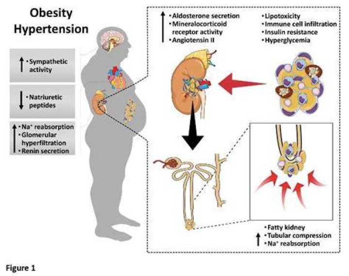 Why obesity causes hypertension?