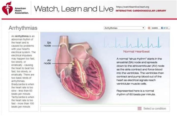 Will an aed shock ventricular tachycardia?