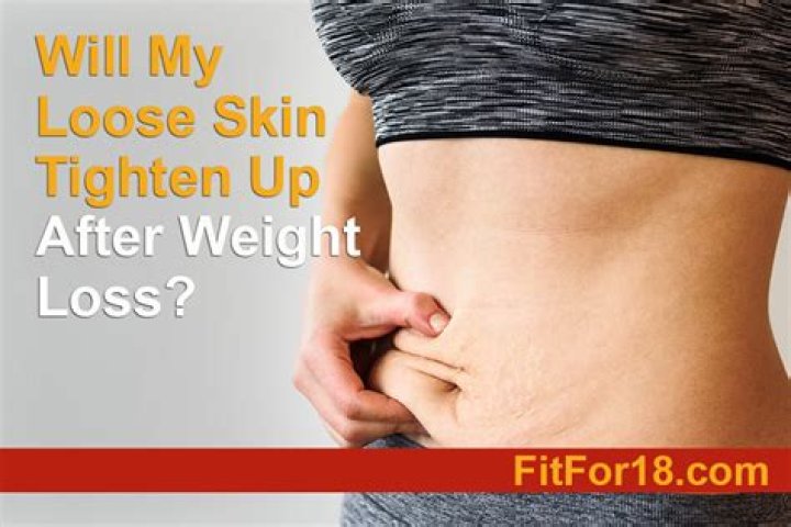 Will loose skin tighten over time?