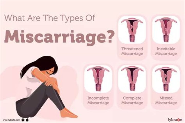 Would i have morning sickness if i miscarried?